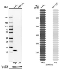 S100A16 Antibody, Novus Biologicals 0.1mL; Unlabeled:Antibodies, Polyclonal